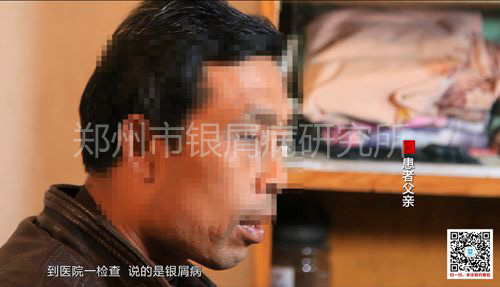蜕去“牛皮”，重拾健康微笑-1.jpg